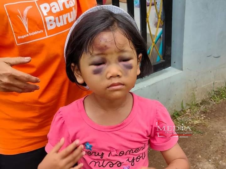 Jamkeswatch Bantu Hilangkan Trauma Gadis Cilik Korban Gempa Cianjur